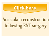 Auricular reconstruction following ENT surgery
