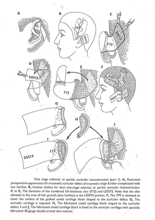 laceration caused by broken glass