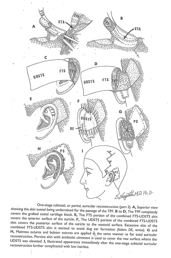 laceration caused by broken glass