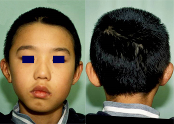 Post-operative appearance