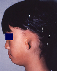 Preoperative appearance