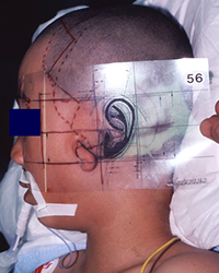 Preoperative appearance