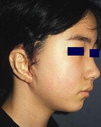 Post-operative Appearance