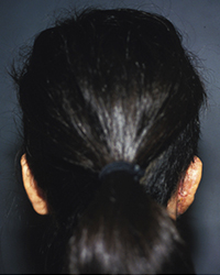 Post-operative Appearance