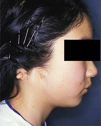 Post-operative Appearance