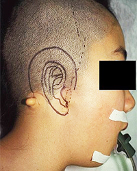 Post-operative Appearance