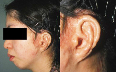 Post-operative Appearance