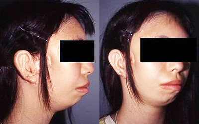 Post-operative Appearance