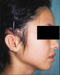 Post-operative Appearance