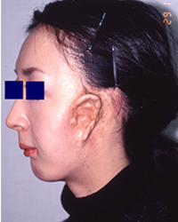 Preoperative appearance