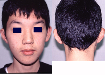 Preoperative Appearance