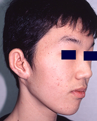 Post-operative Appearance