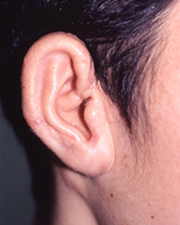 Post-operative Appearance