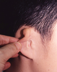 Preoperative Appearance