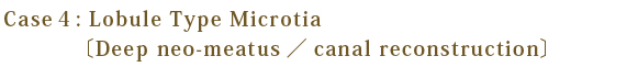 Loble Type microtia〔Deep neo-meatus／canal reconstruction〕