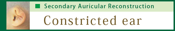 Constricted ear