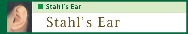 Stahl's ear