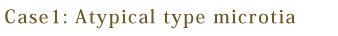 Atypical type microtia