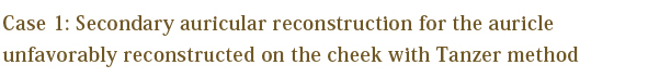 Case 1: Secondary auricular reconstruction for the auricle unfavorably reconstructed on the cheek with Tanzer method