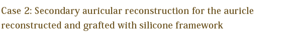 Case 2: Secondary auricular reconstruction for the auricle reconstructed and grafted with silicone framework
