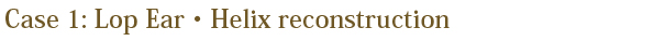 case1:Lop Ear・Helix reconstruction
