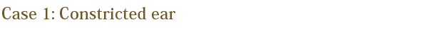 case1:Constricted