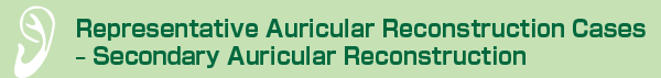 Representative Auricular Reconstruction Cases - Secondary Auricular Reconstruction