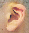 Lop Ear